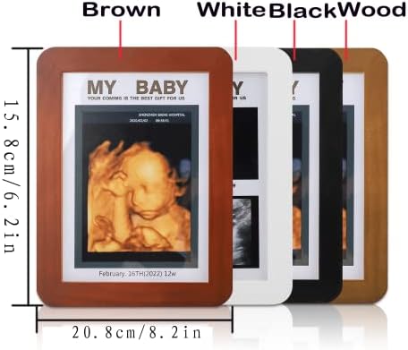 Рамка за снимка с Сонограммой Дете, Ултразвукова Фоторамка Реклама за бременност, Рамка за Снимка с Сонограммой, Неутрален