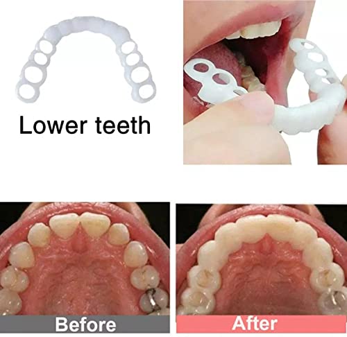 Фасети за горните и долните зъби WENHAR - Имитира тиранти, защелкивающиеся при усмивка, покриващи зъбите, идеално избелване,