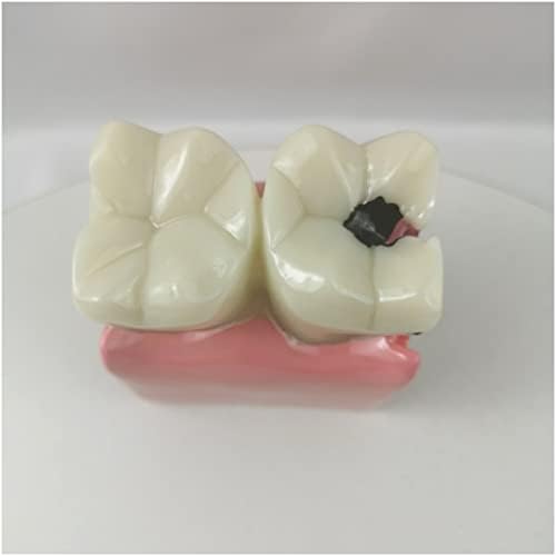 KH66ZKY Грижи за стандартния модел на зъби - Модел на Сравнителни изследвания на зъбите с 6-Кратно за унищожаване